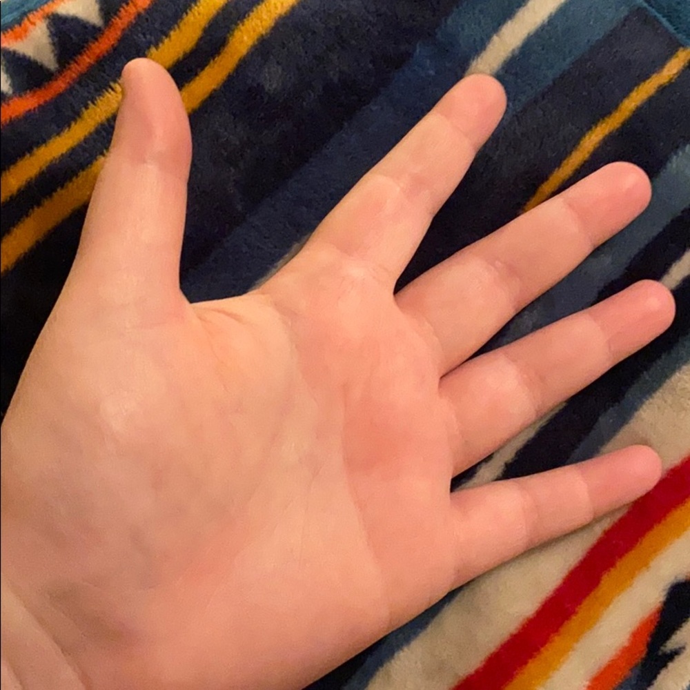 These hands - Picture 3 of 4